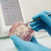 Remboursement orthodontie : ce qu’il faut savoir avant de commencer un traitement