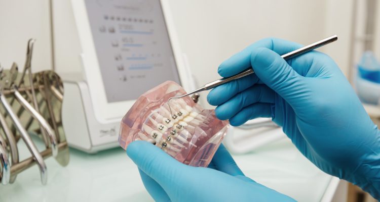 Remboursement orthodontie : ce qu’il faut savoir avant de commencer un traitement