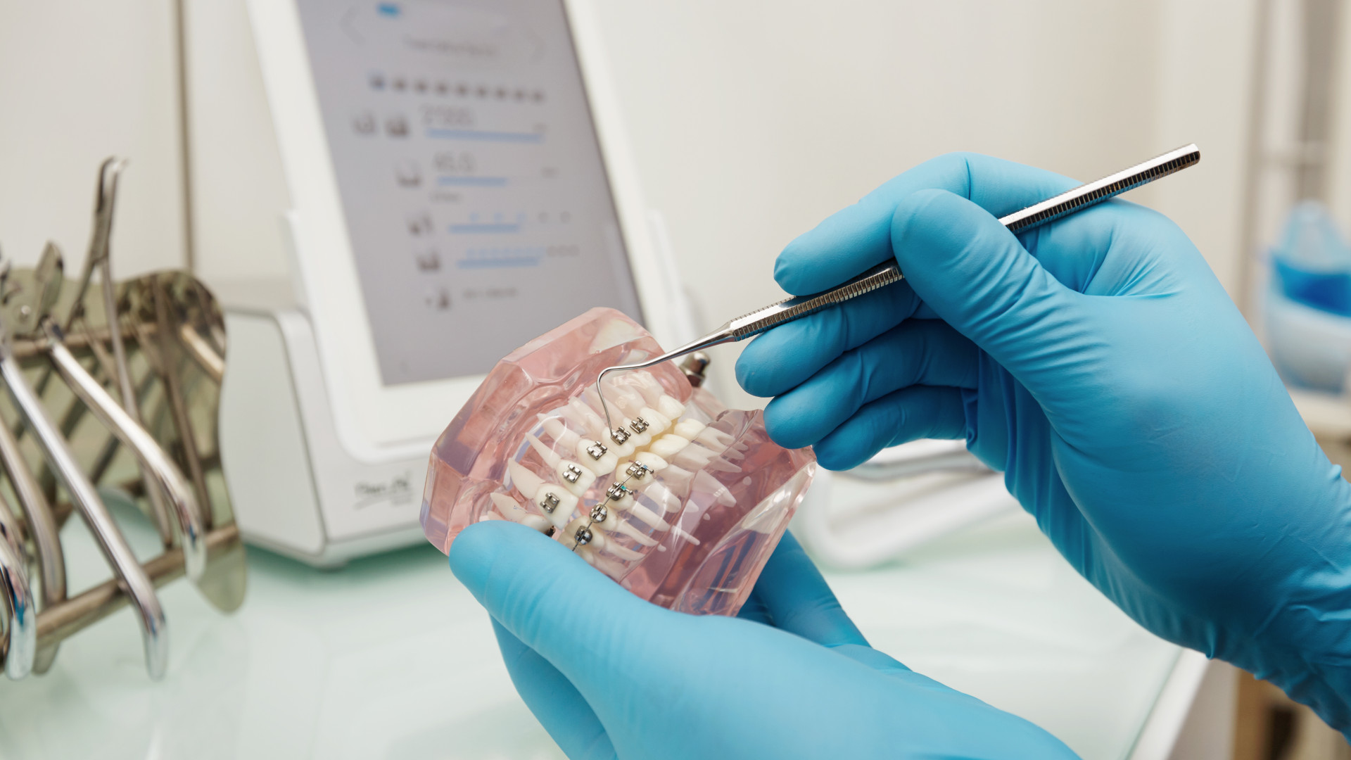 Remboursement orthodontie : ce qu’il faut savoir avant de commencer un traitement